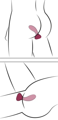 Anaplug mit Fernbedienung aus Silikon