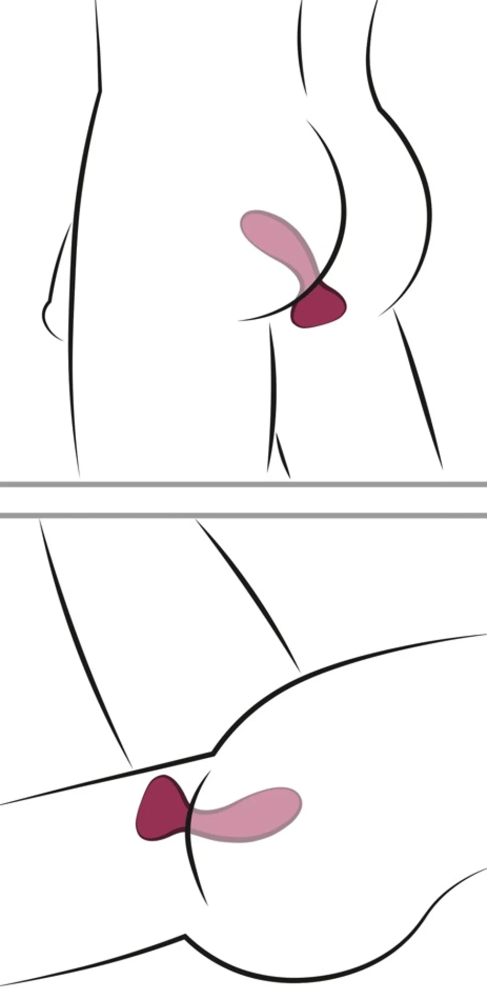 Anaplug mit Fernbedienung aus Silikon